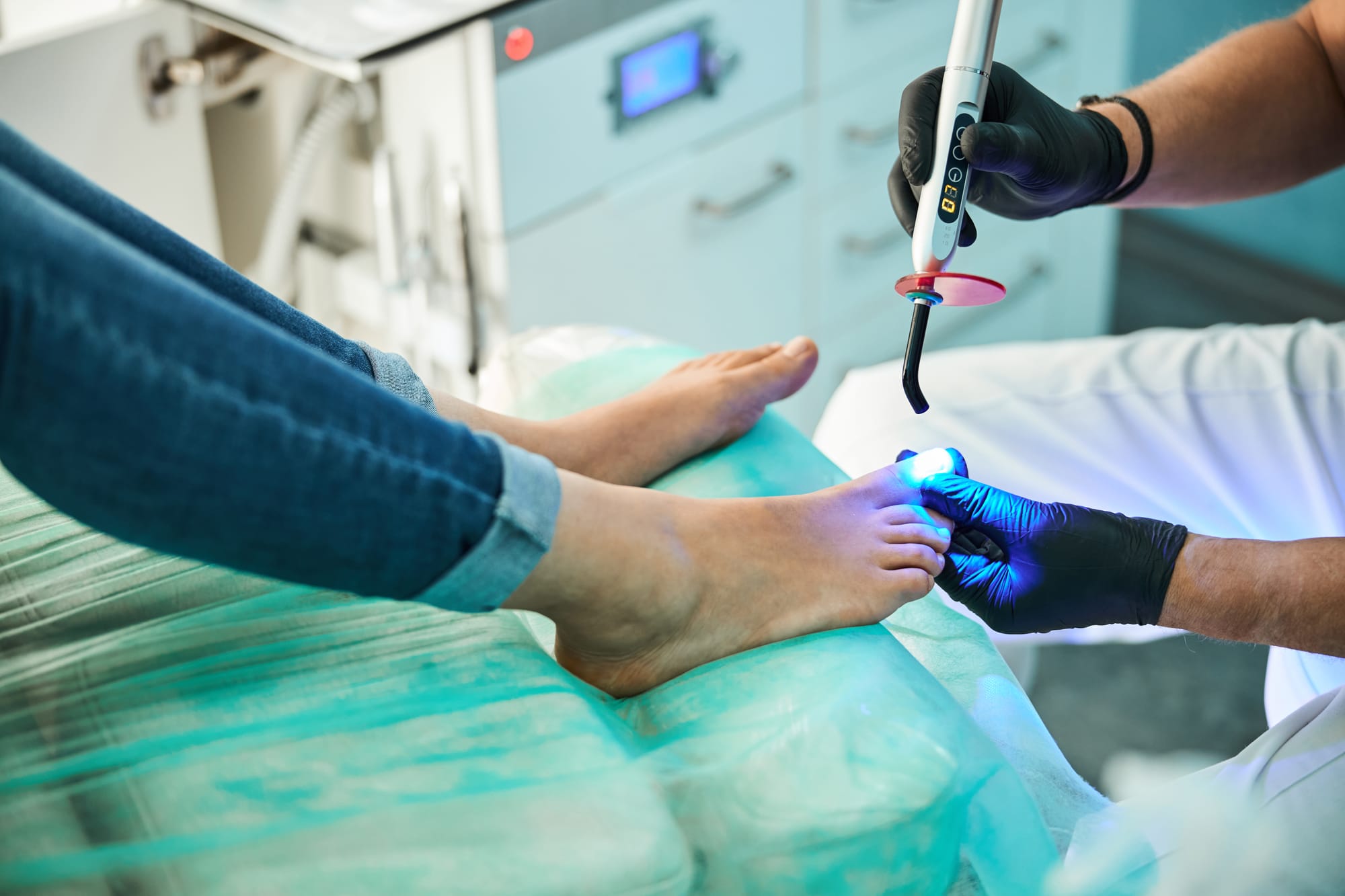 Toenail fungal laser therapy