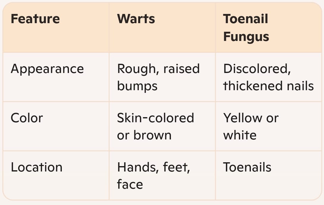 Visual differences of wart and fungal infections in toenails