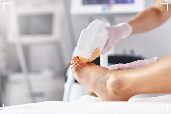 laser treatments for toenail fungal infections